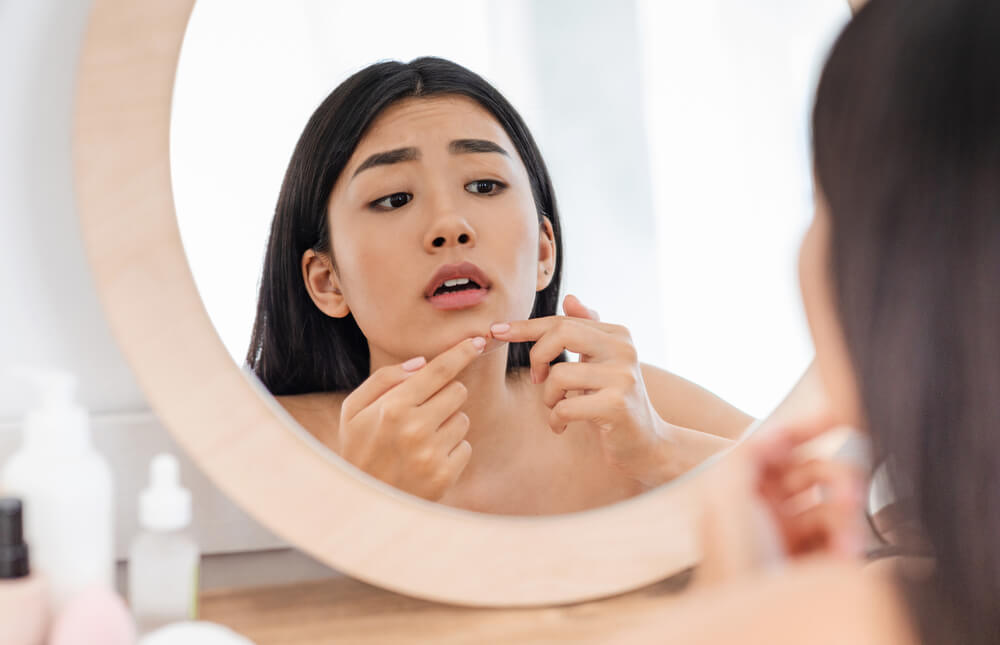 What Your Acne is Trying to Tell You About Your Health