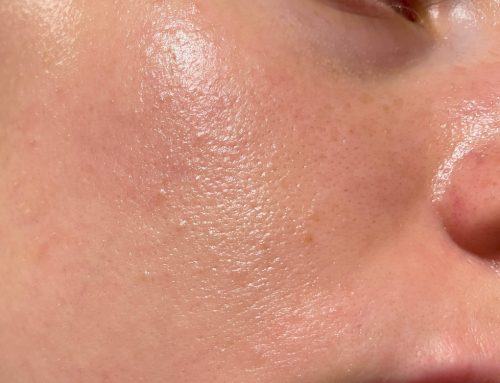 Do THIS if You Have Oily Skin